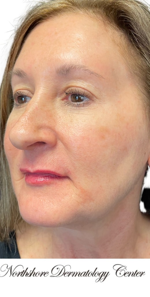 After Image: Kysse and Contour Package - left-front-oblique