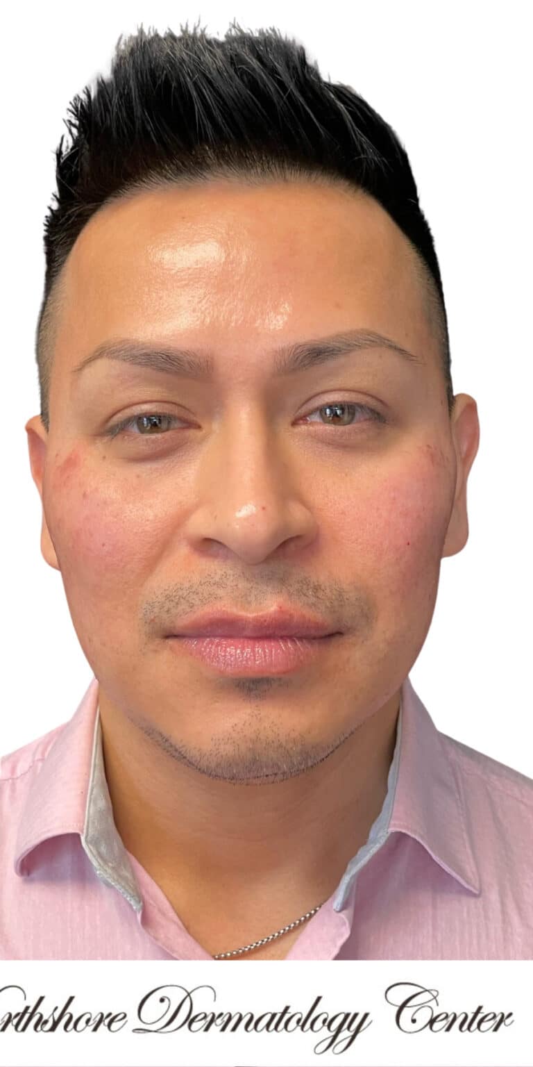 After Image: Kysse and Contour Package - front