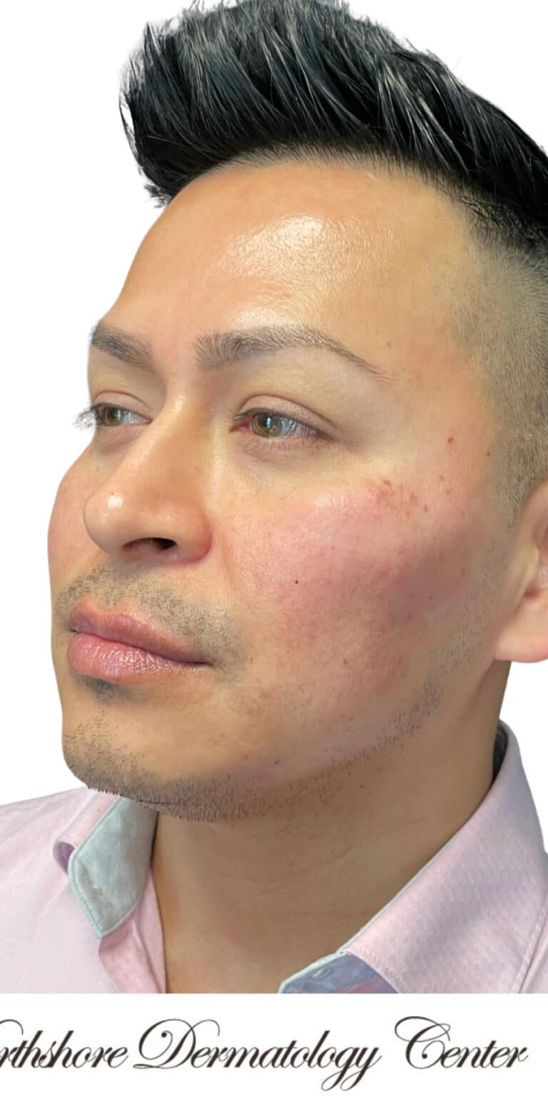 After Image: Kysse and Contour Package - left-front-oblique