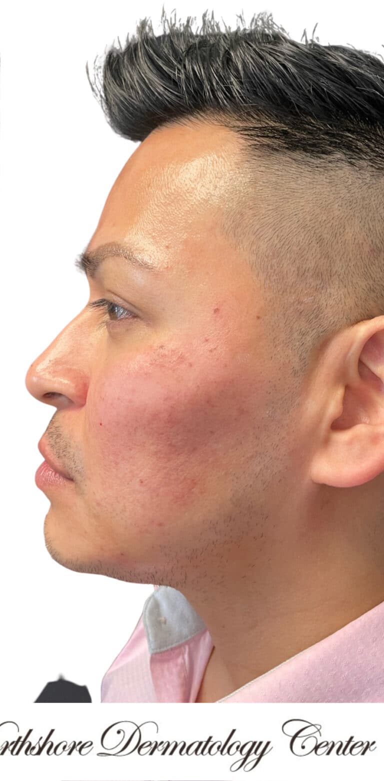 After Image: Kysse and Contour Package - left-side