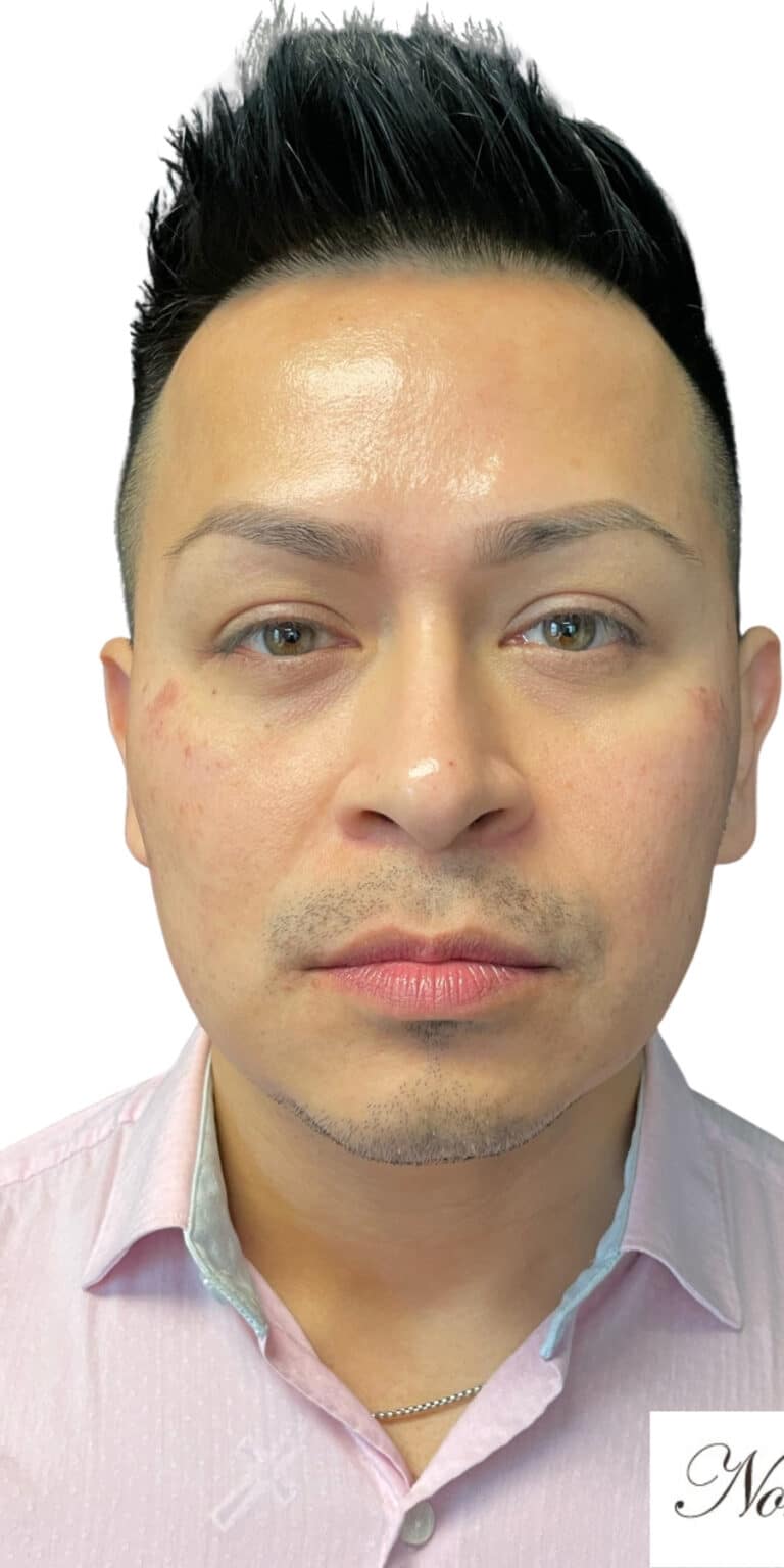 Before Image: Kysse and Contour Package - front