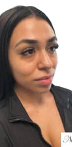 Before Image: Kysse and Contour Package