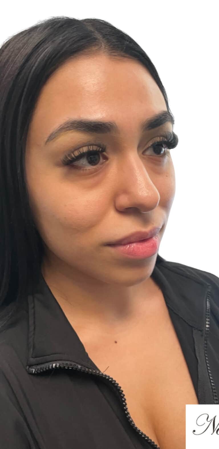 Before Image: Kysse and Contour Package - right-front-oblique