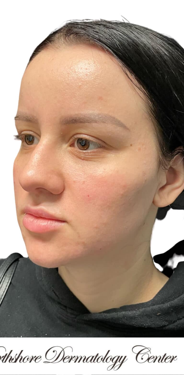 After Image: The Diamond Package - left-front-oblique