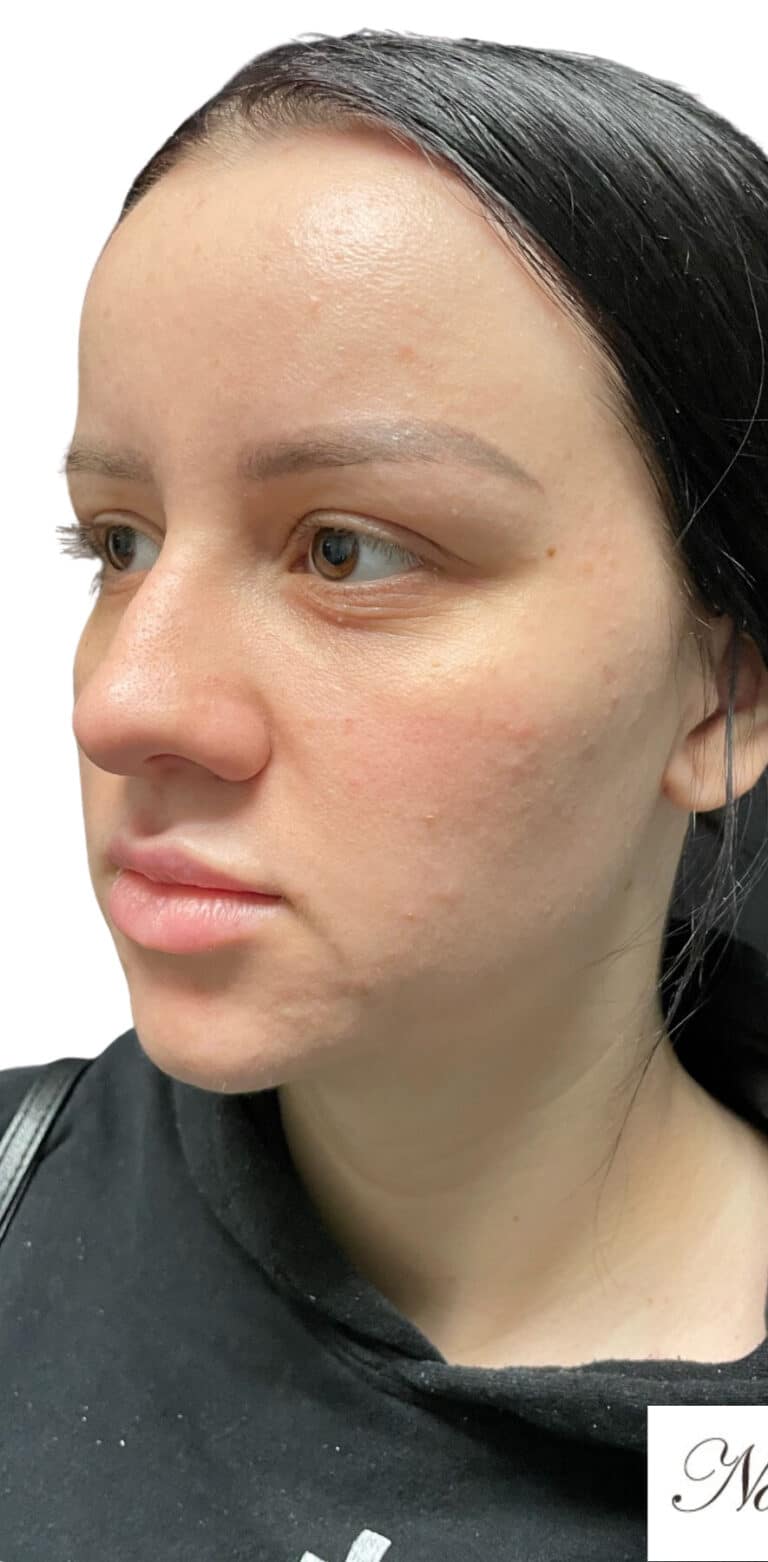 Before Image: The Diamond Package - left-front-oblique