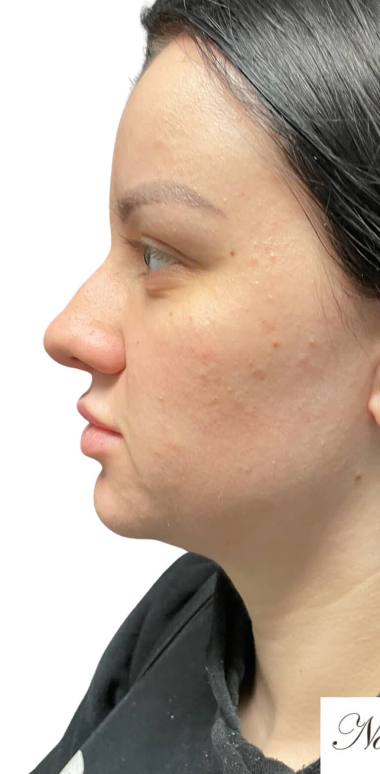Before Image: The Diamond Package - left-side