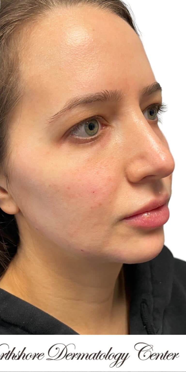 After Image: The Glamour Package - right-front-oblique