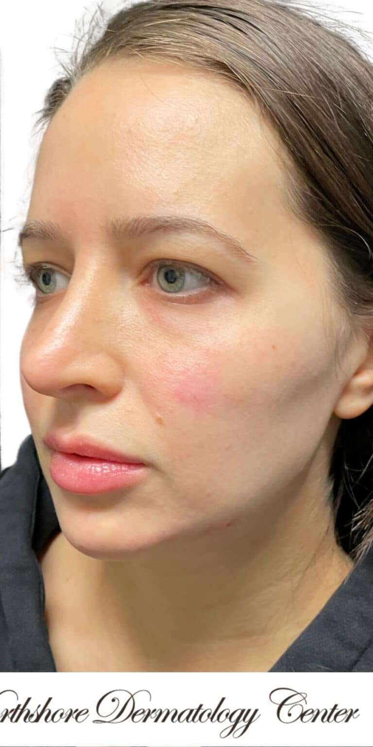 After Image: The Glamour Package - left-front-oblique