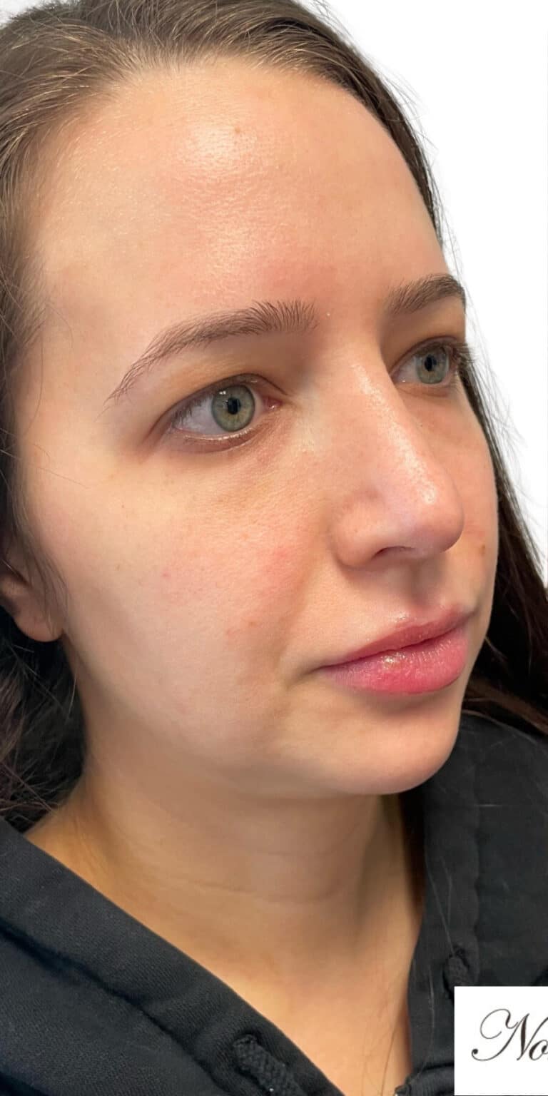 Before Image: The Glamour Package - right-front-oblique
