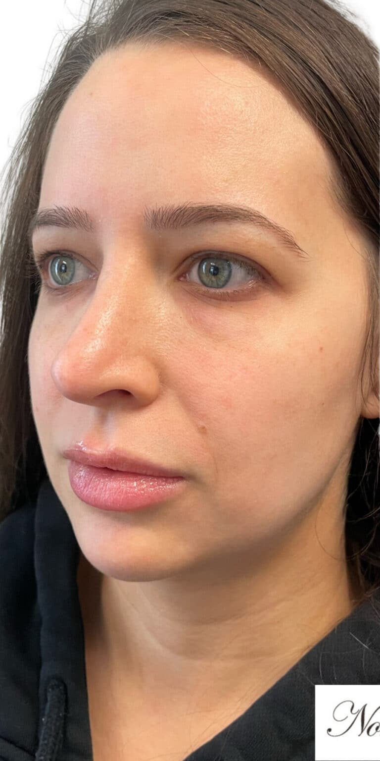 Before Image: The Glamour Package - left-front-oblique