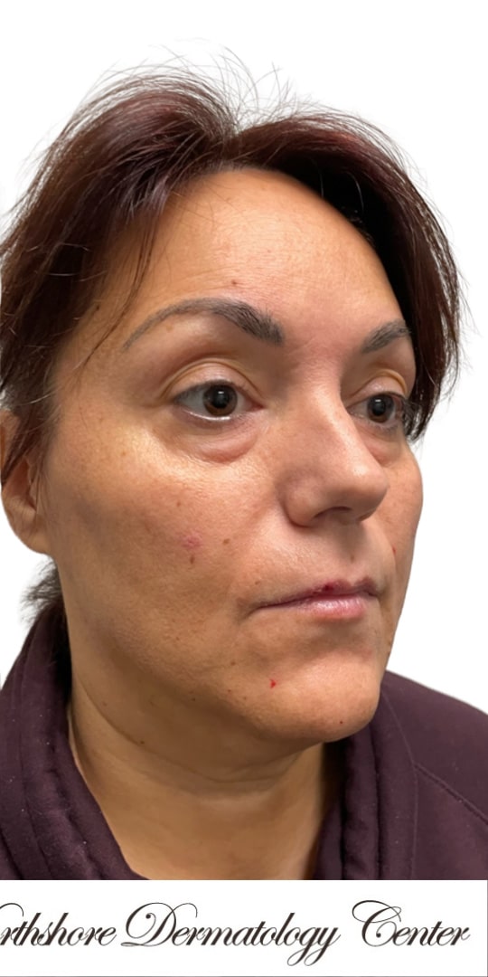 After Image: The Lux Package - right-front-oblique