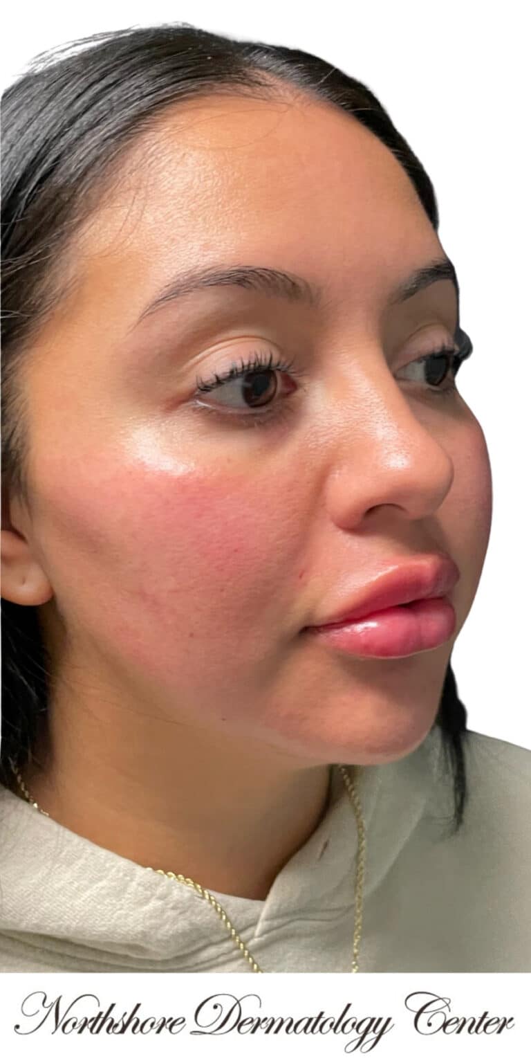 After Image: The Lux Package - right-front-oblique