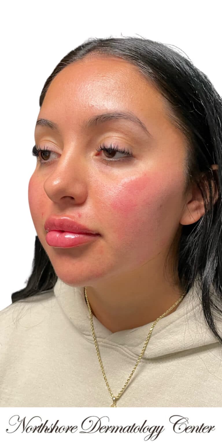 After Image: The Lux Package - left-front-oblique