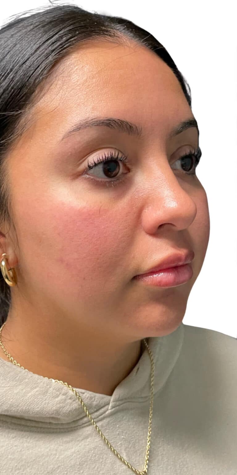 Before Image: The Lux Package - right-front-oblique