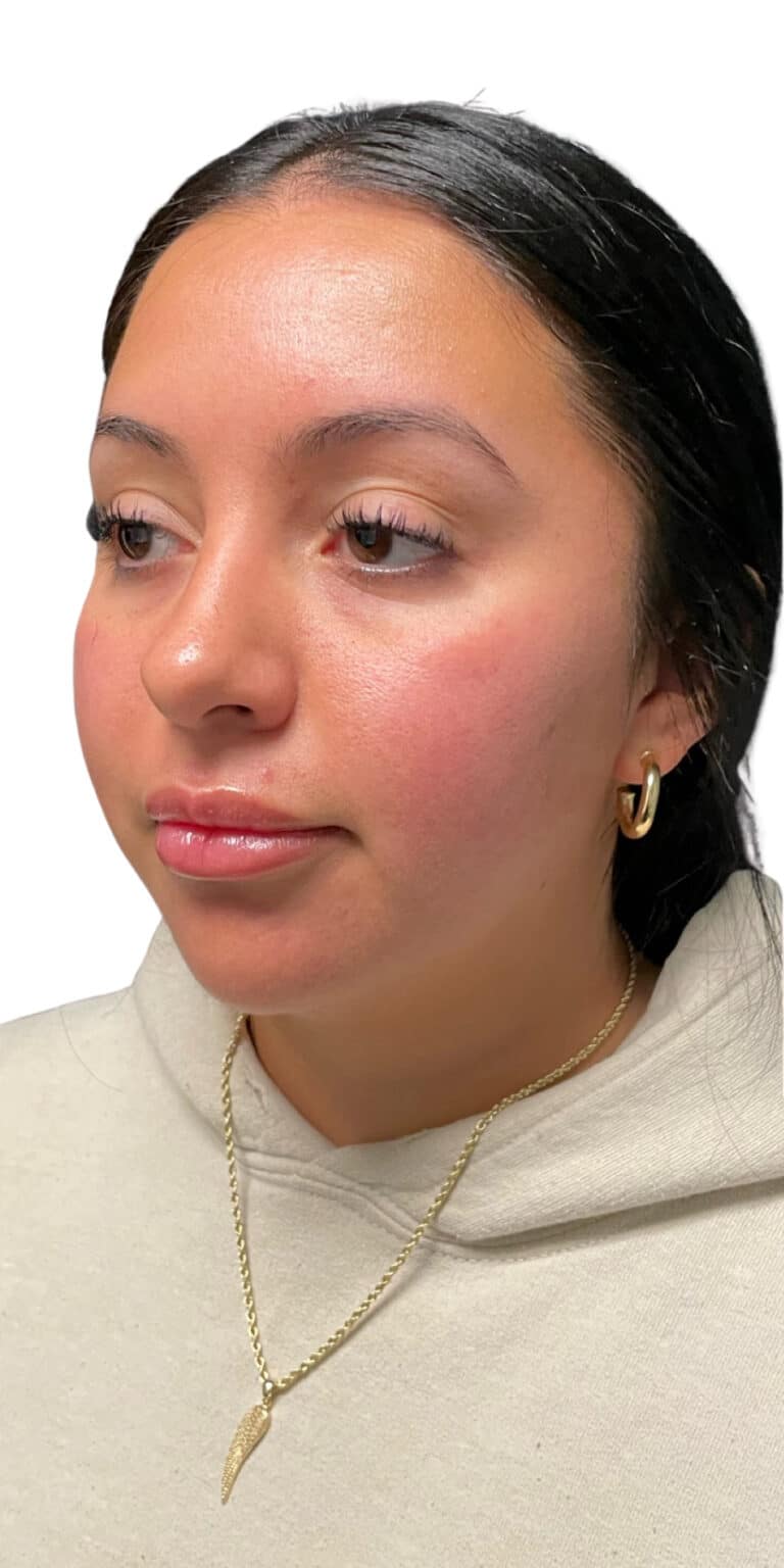 Before Image: The Lux Package - left-front-oblique