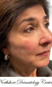 After Image: Kysse and Contour