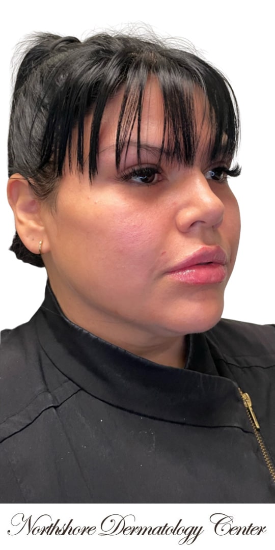 After Image: Kysse and Contour - right-front-oblique