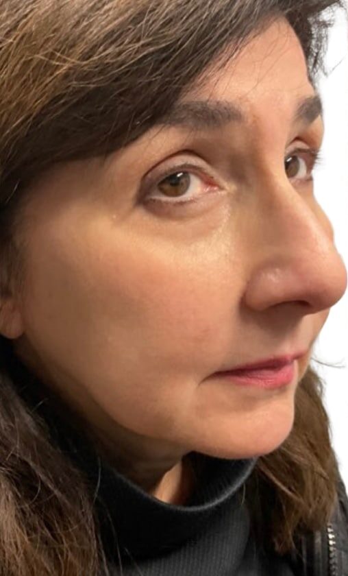Before Image: Kysse and Contour - right-front-oblique