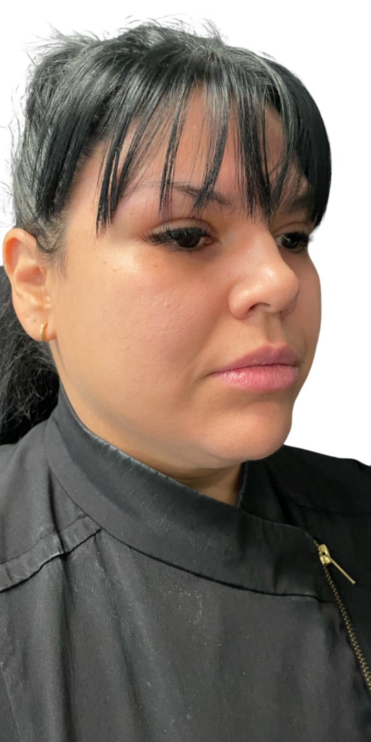 Before Image: Kysse and Contour - right-front-oblique